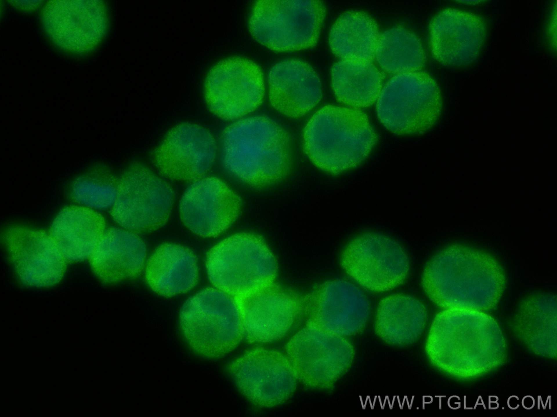 IF Staining of K-562 using 30906-1-AP