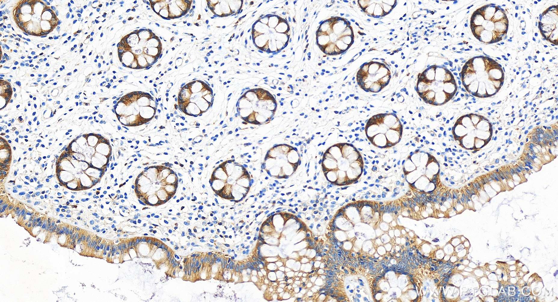 IHC staining of human colon using 84231-4-RR