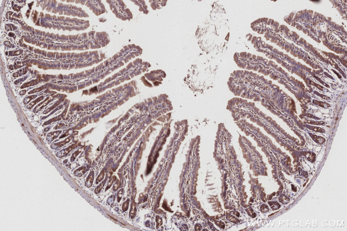 IHC staining of mouse small intestine using 84231-4-RR IHC staining of mouse small intestine using 84231-4-RR