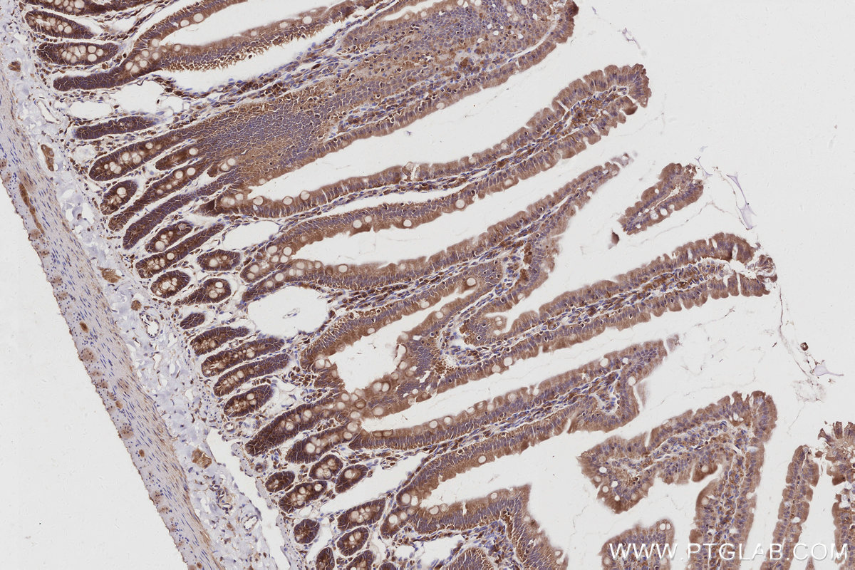 IHC staining of rat small intestine using 84231-4-RR IHC staining of rat small intestine using 84231-4-RR