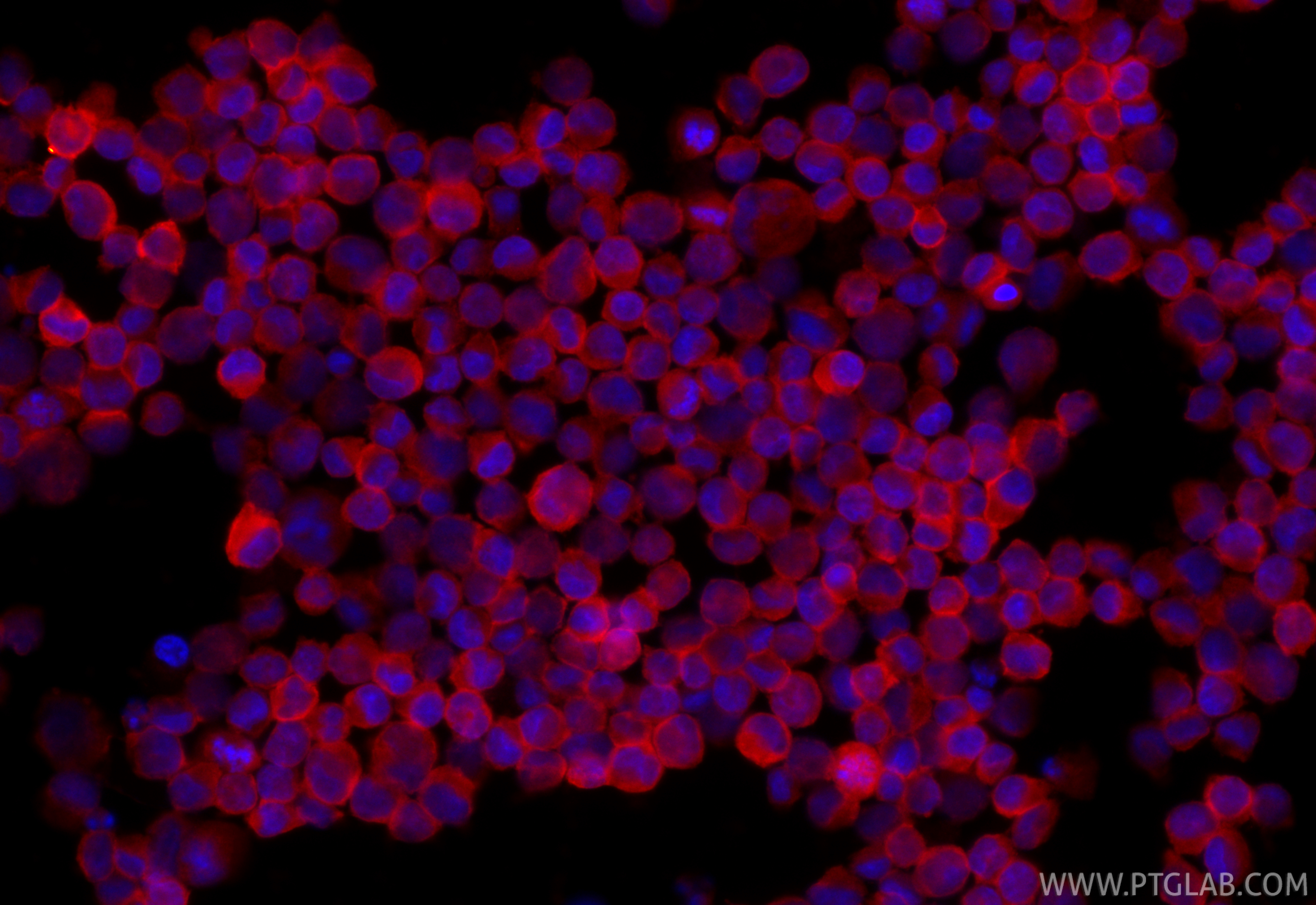 IF Staining of K-562 using CL594-84231-4 IF Staining of K-562 using CL594-84231-4