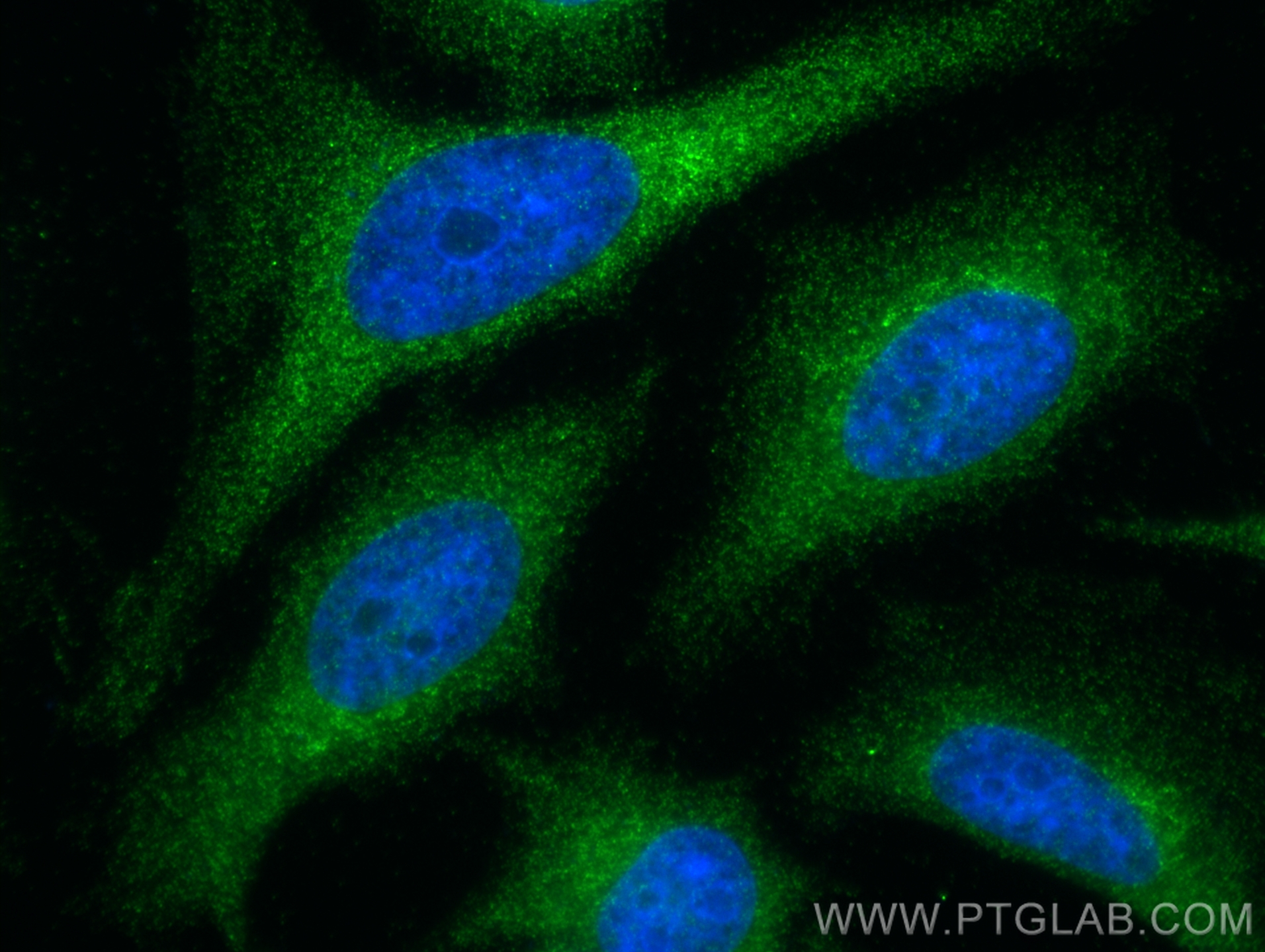 IF Staining of HeLa using 15104-1-AP