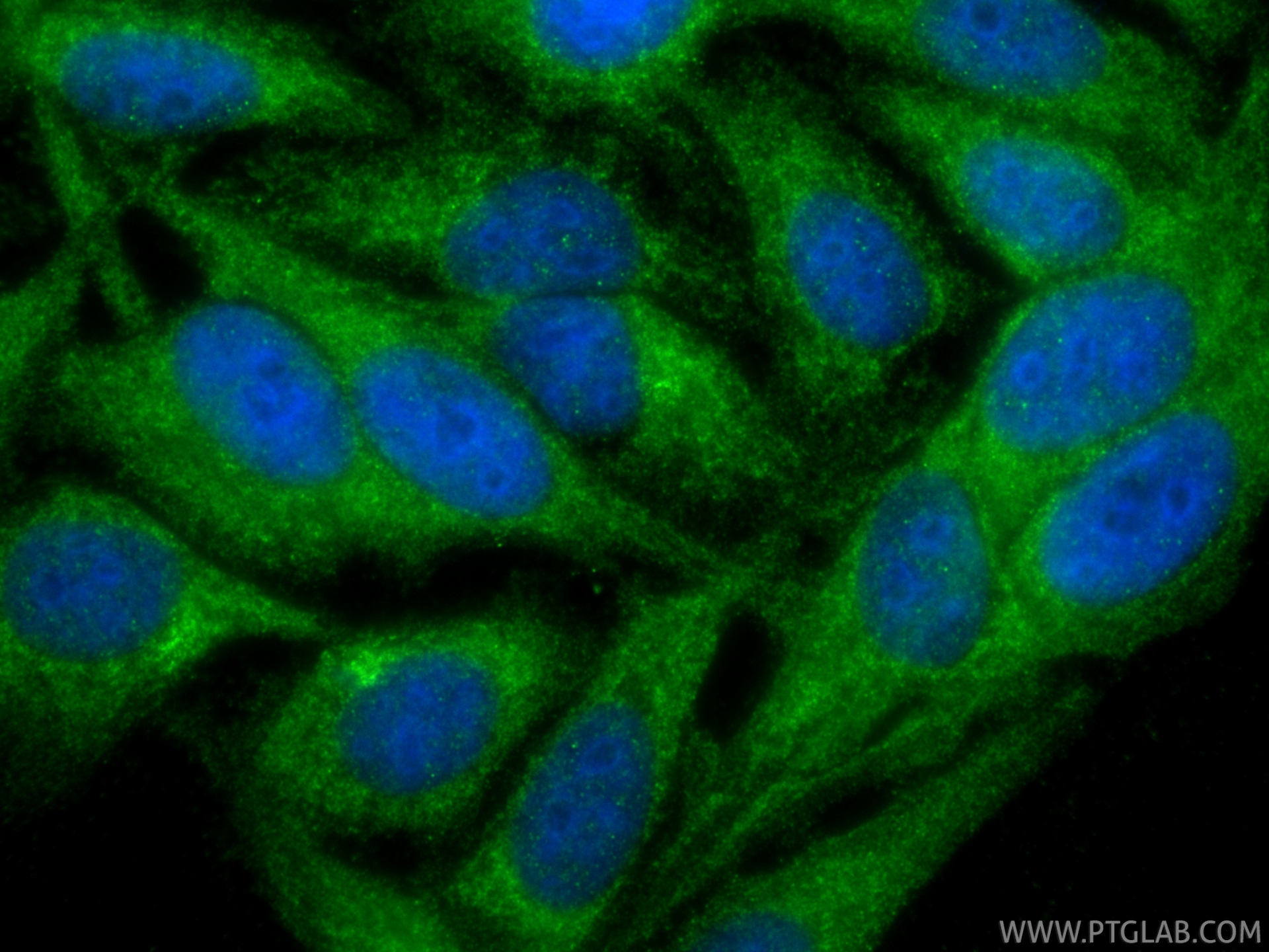 IF Staining of HepG2 using 15459-1-AP