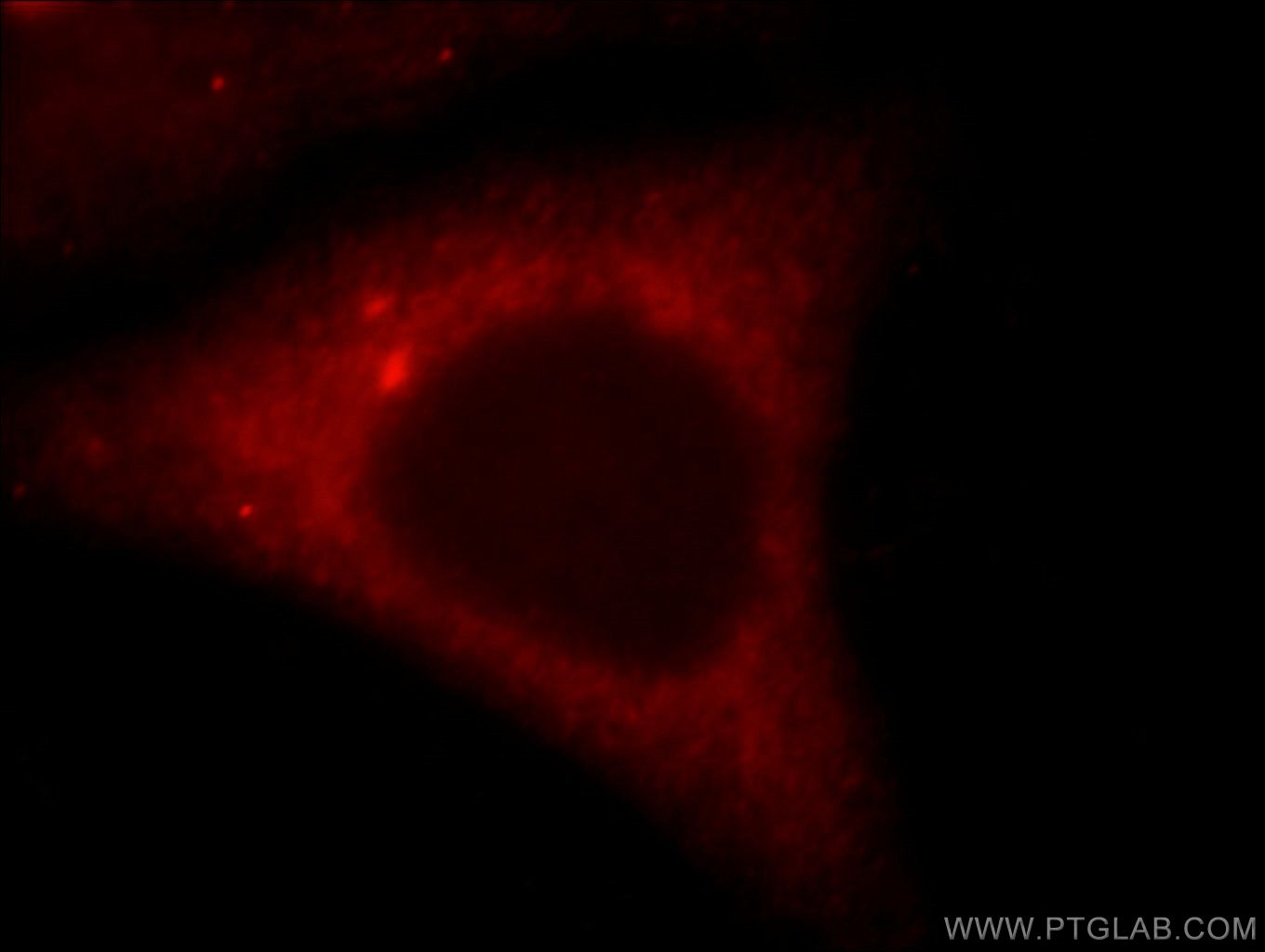 IF Staining of HepG2 using 15459-1-AP