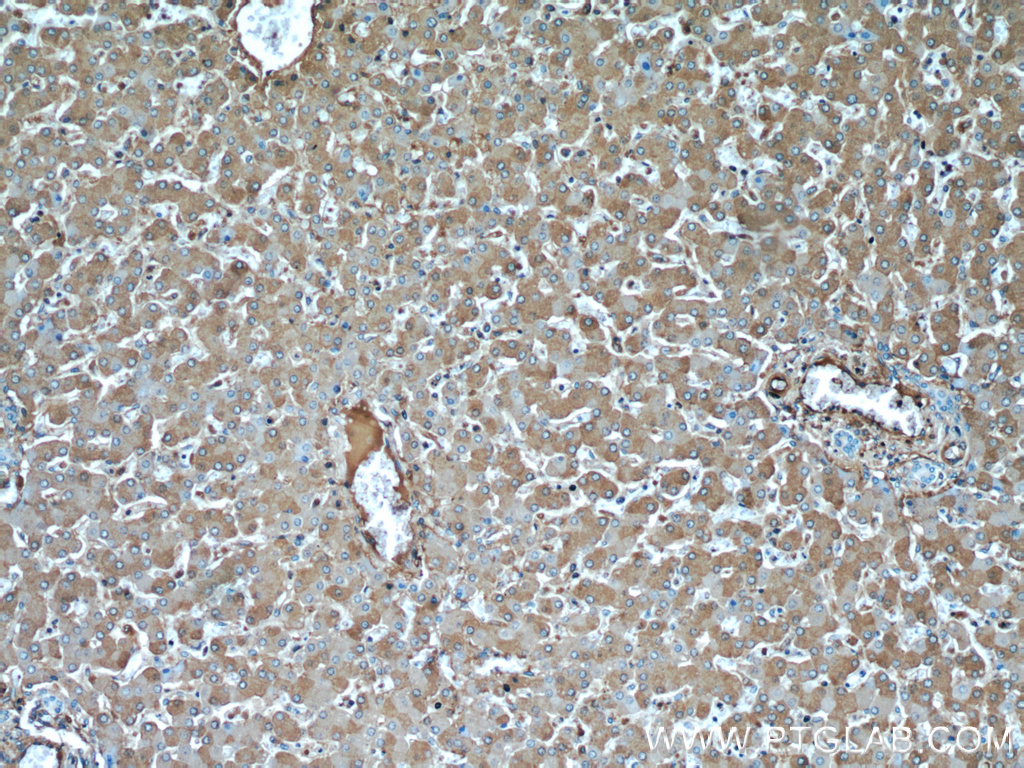 IHC staining of human liver using 15459-1-AP