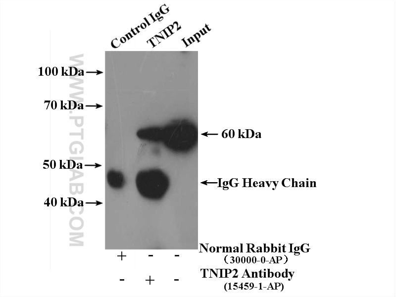 IP experiment of HepG2 using 15459-1-AP