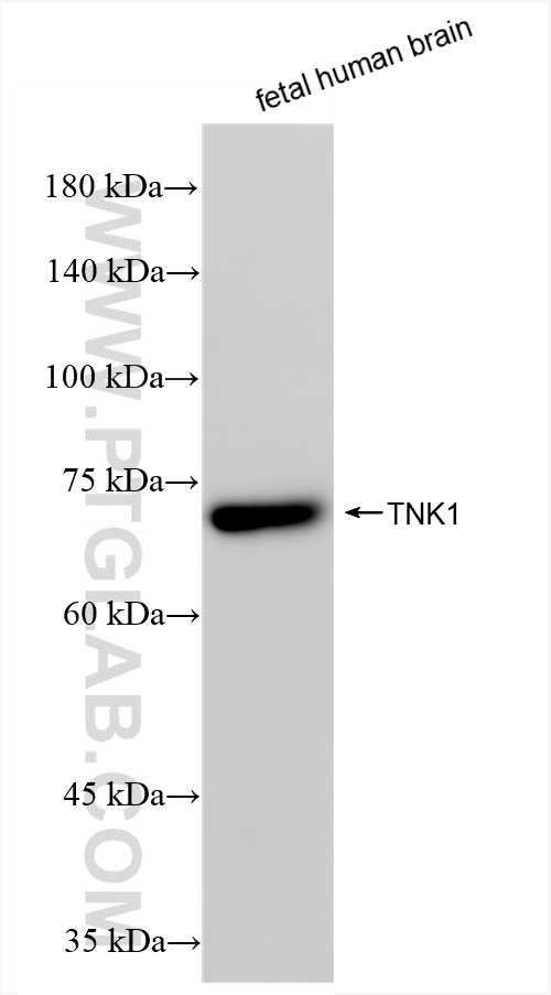 WB analysis of fetal human brain using 86190-2-RR