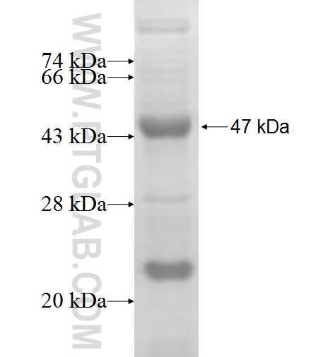ACK1 fusion protein Ag5419 SDS-PAGE