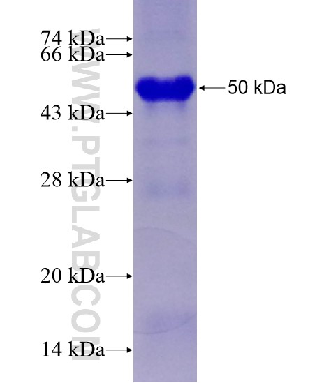 TNKS fusion protein Ag28838 SDS-PAGE