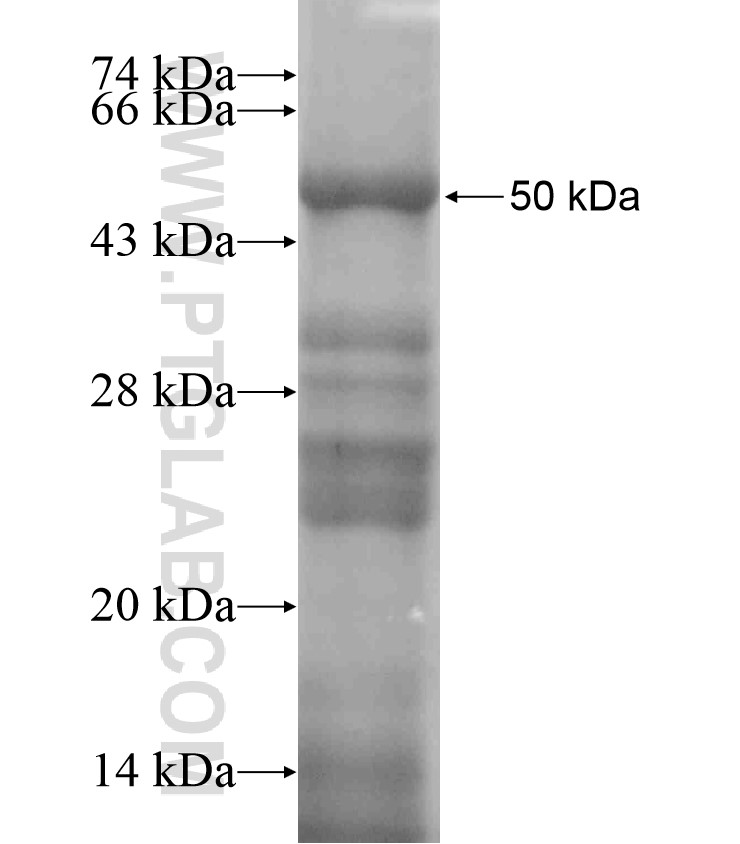 TNMD fusion protein Ag18291 SDS-PAGE TNMD fusion protein Ag18291 SDS-PAGE