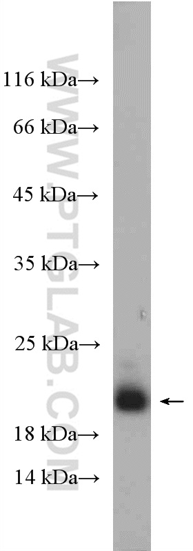 WB analysis of mouse skeletal muscle using 13504-1-AP