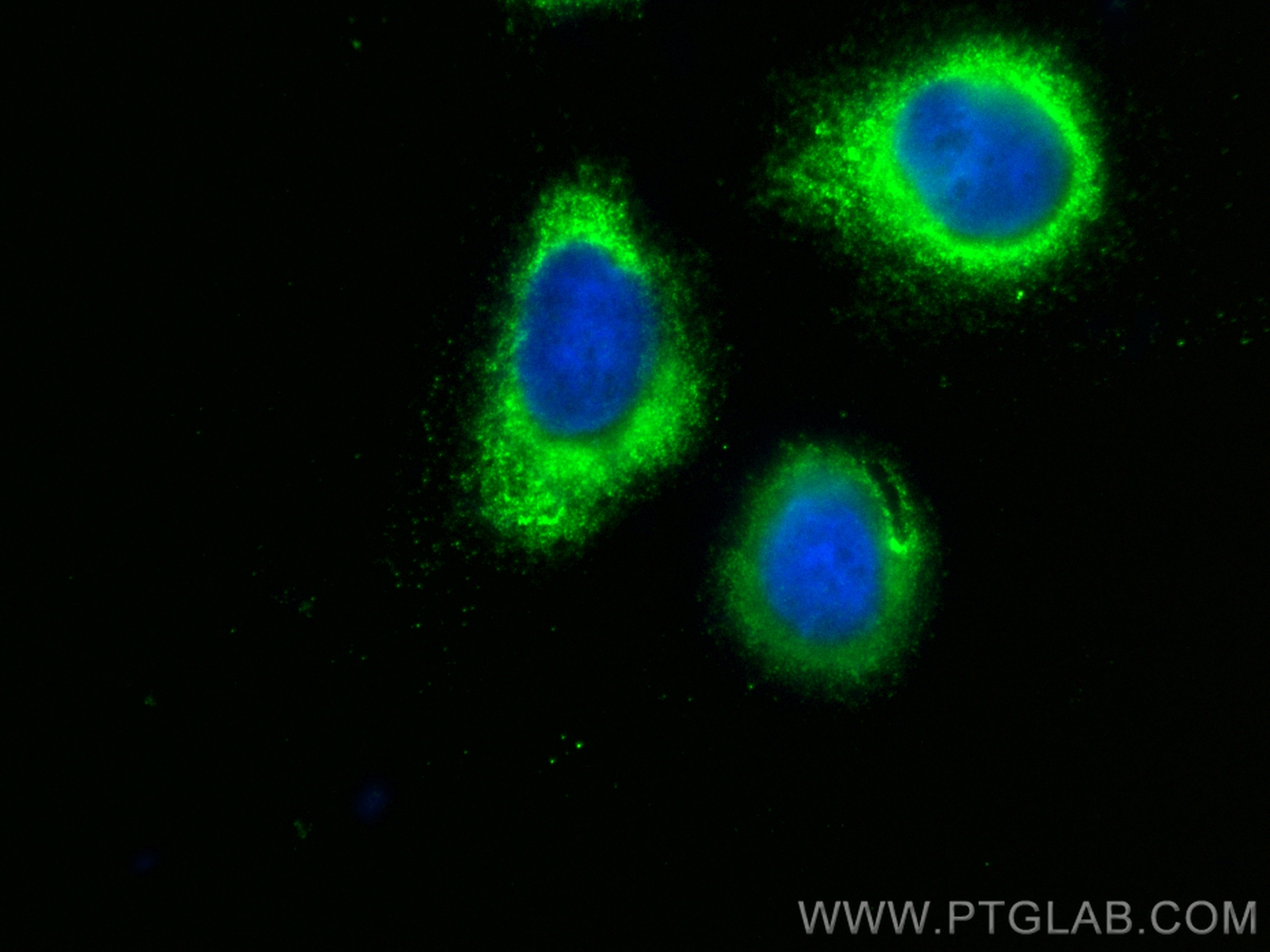 IF Staining of U2OS using CL488-13504