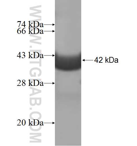 TNNC2 fusion protein Ag8636 SDS-PAGE