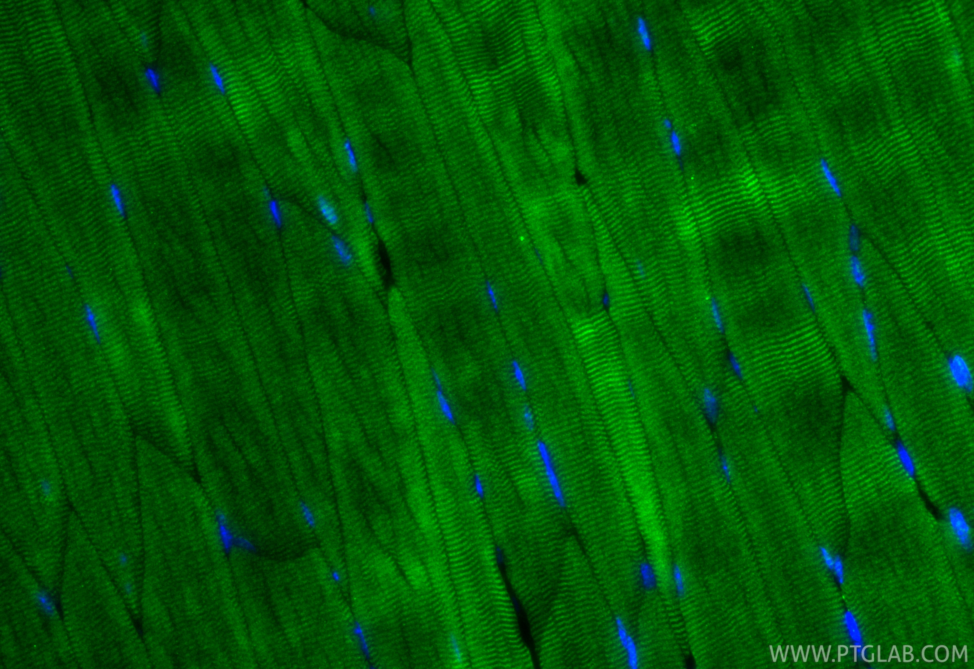 IF Staining of mouse skeletal muscle using 16102-1-AP IF Staining of mouse skeletal muscle using 16102-1-AP