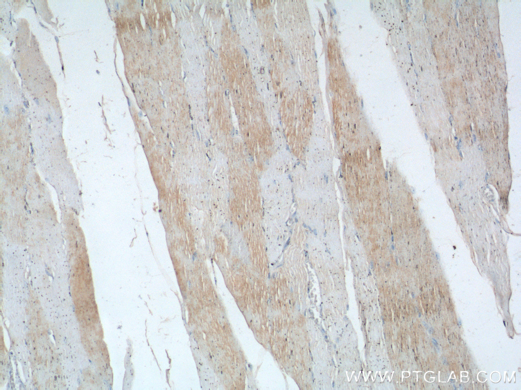 IHC staining of human skeletal muscle using 16102-1-AP
