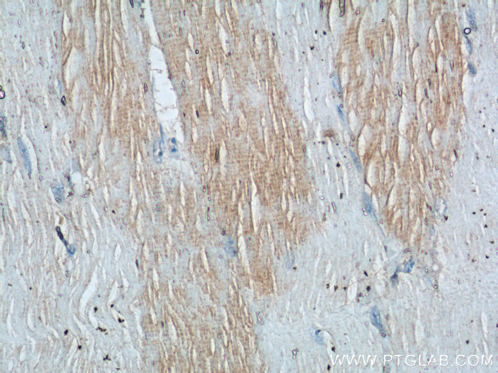 IHC staining of human skeletal muscle using 16102-1-AP