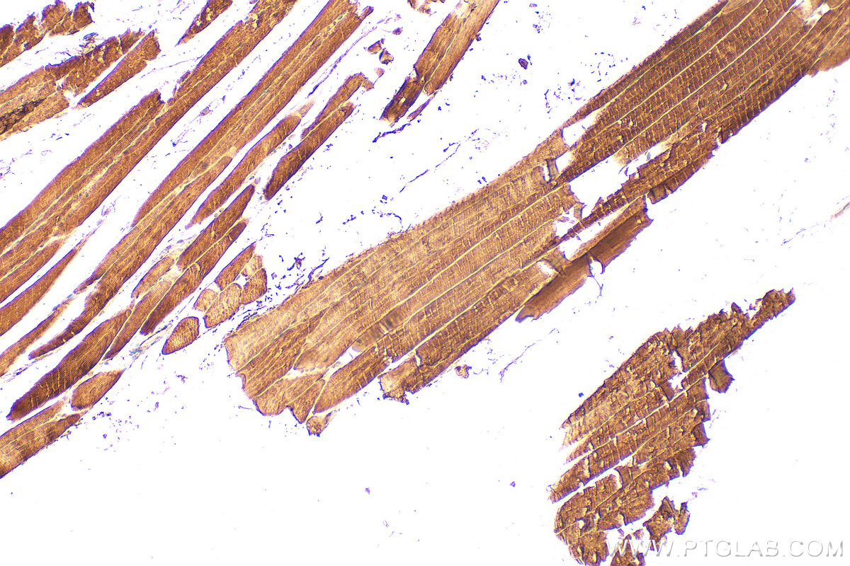 IHC staining of mouse skeletal muscle using 16102-1-AP IHC staining of mouse skeletal muscle using 16102-1-AP