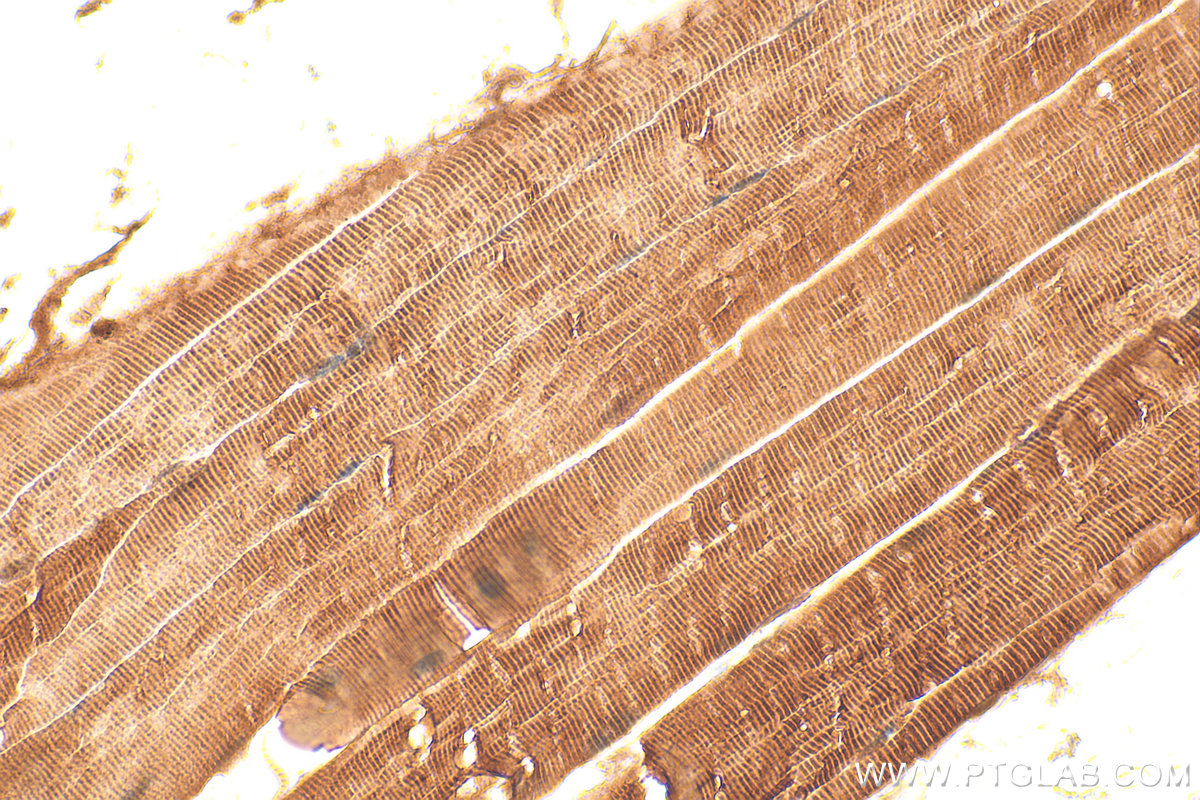 IHC staining of mouse skeletal muscle using 16102-1-AP IHC staining of mouse skeletal muscle using 16102-1-AP