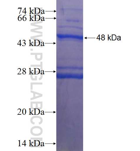 TNNI1 fusion protein Ag9001 SDS-PAGE