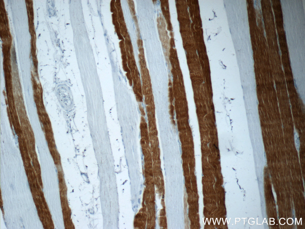 TNNI2 Polyclonal antibody