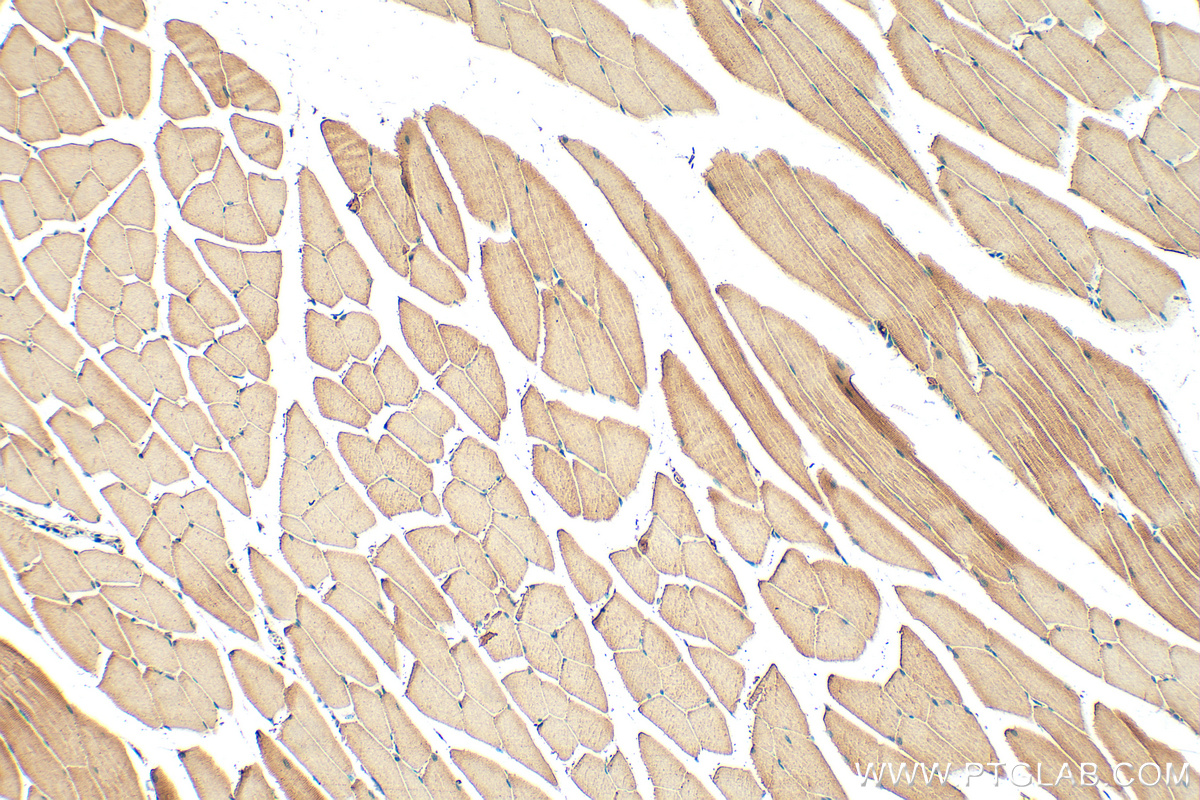 IHC staining of mouse skeletal muscle using 11634-1-AP (same clone as 11634-1-PBS)