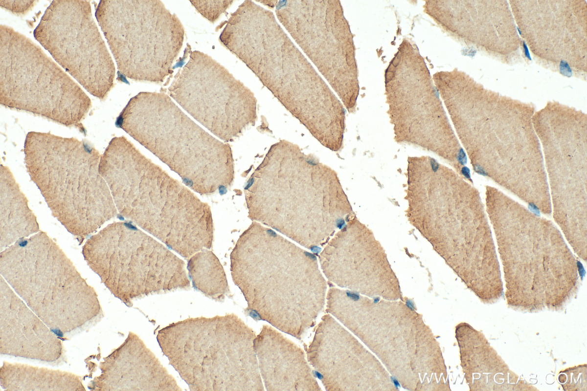 IHC staining of mouse skeletal muscle using 11634-1-AP