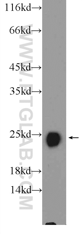 WB analysis of mouse skeletal muscle using 11634-1-AP (same clone as 11634-1-PBS)