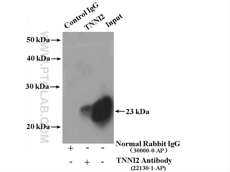 IP experiment of mouse skeletal muscle using 22130-1-AP