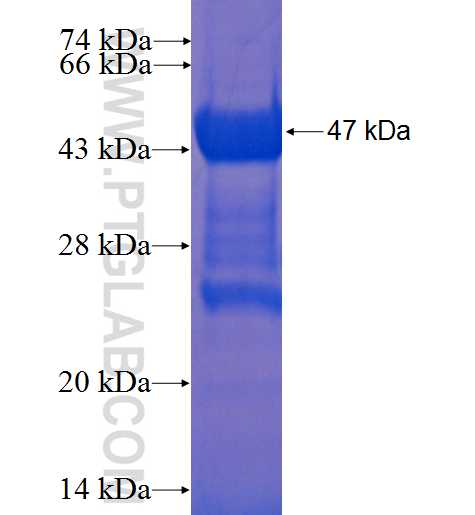 TNNI2 fusion protein Ag2208 SDS-PAGE