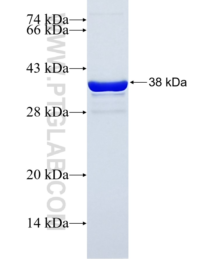 TNNI3 fusion protein Ag16365 SDS-PAGE