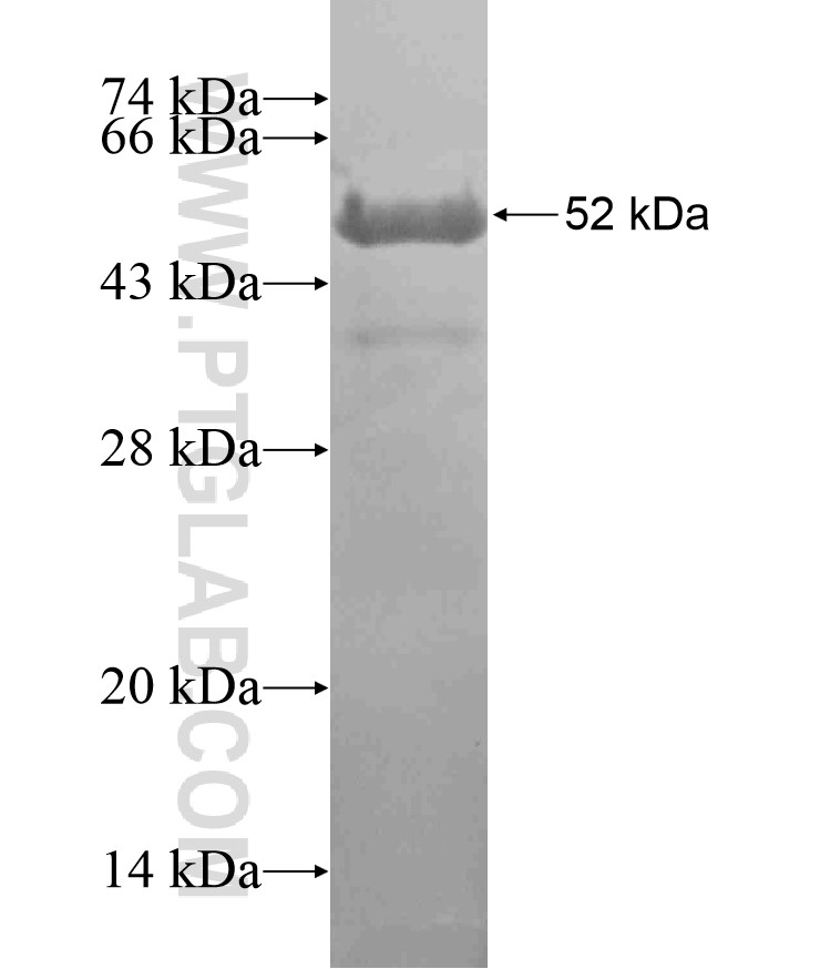 TNNT2 fusion protein Ag17751 SDS-PAGE
