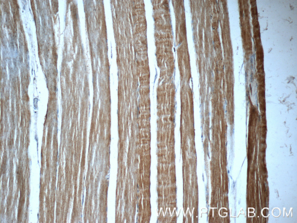 IHC staining of human skeletal muscle using 19729-1-AP
