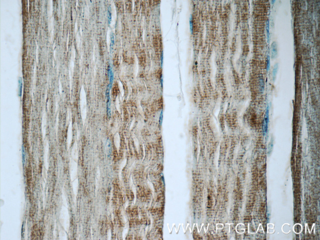 IHC staining of human skeletal muscle using 19729-1-AP