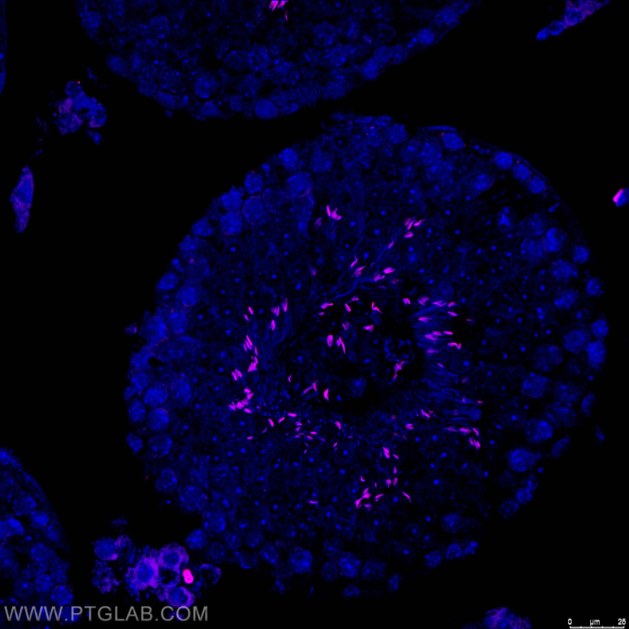 IF Staining of mouse testis using CL555-17178