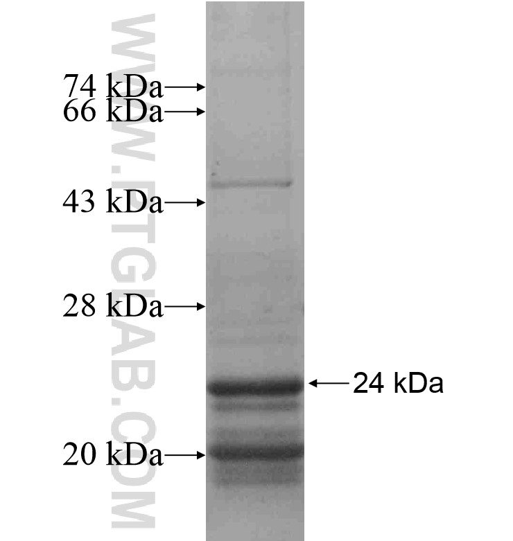 TNP2 fusion protein Ag16762 SDS-PAGE TNP2 fusion protein Ag16762 SDS-PAGE