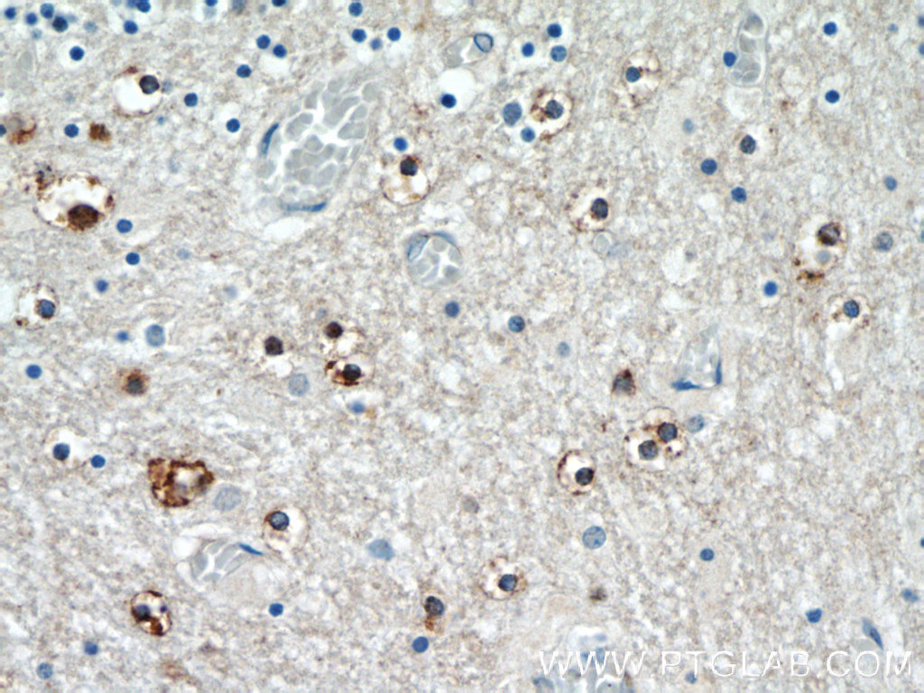 IHC staining of human cerebellum using 25353-1-AP