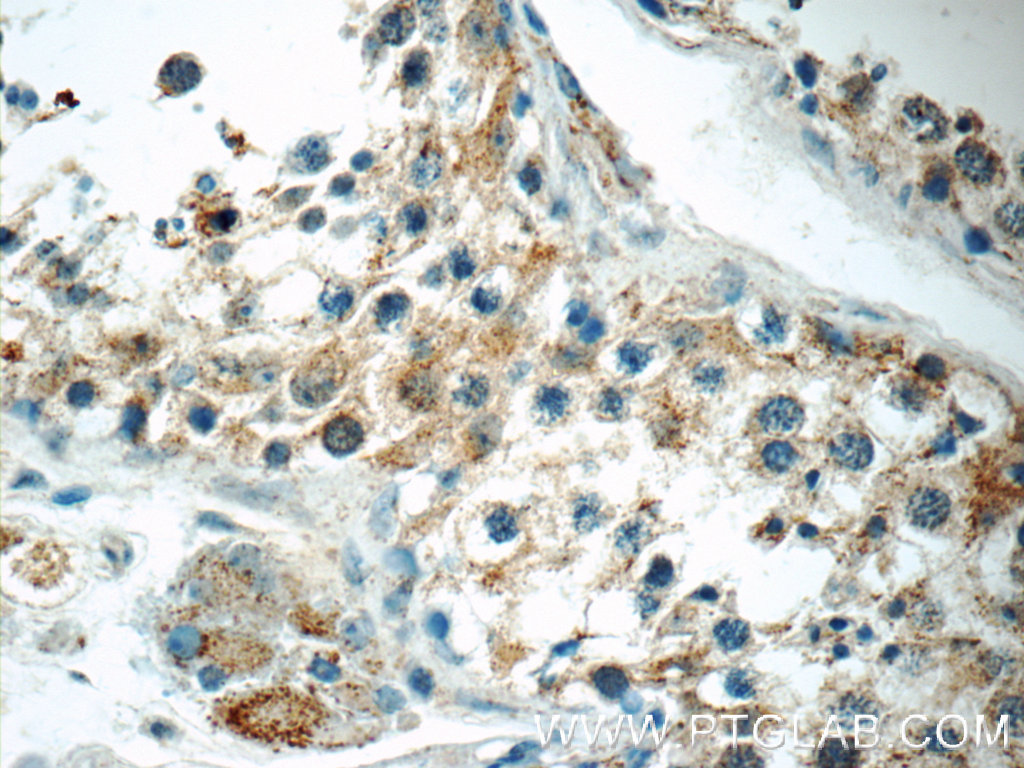 IHC staining of human testis using 25353-1-AP