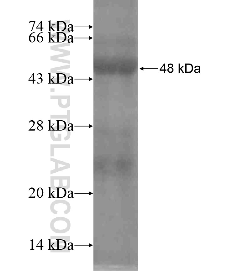 TNRC4 fusion protein Ag18305 SDS-PAGE TNRC4 fusion protein Ag18305 SDS-PAGE