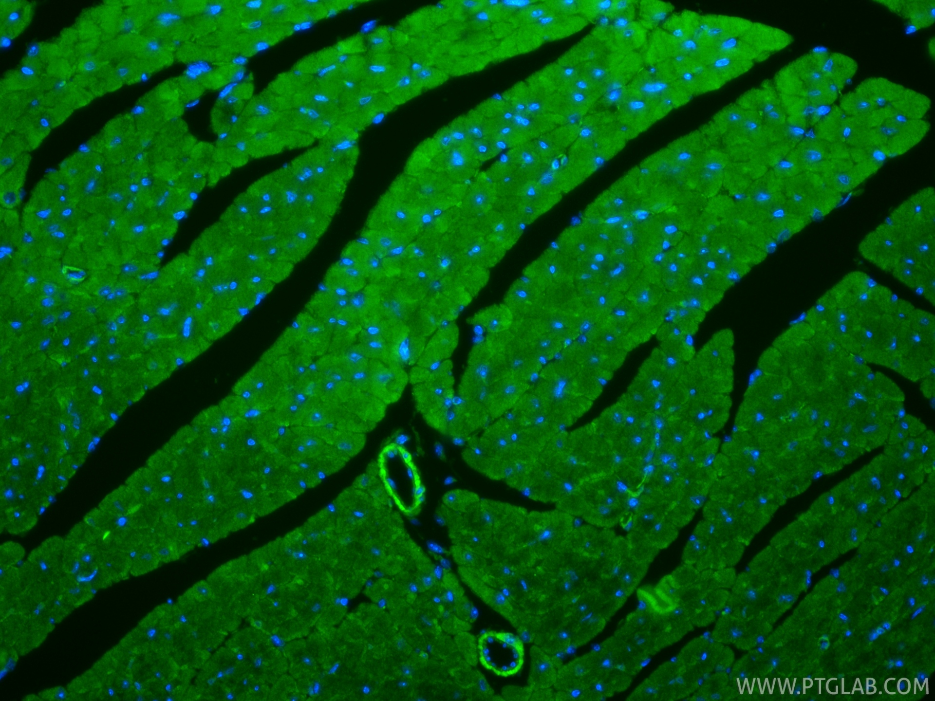 IF Staining of mouse heart using 20054-1-AP