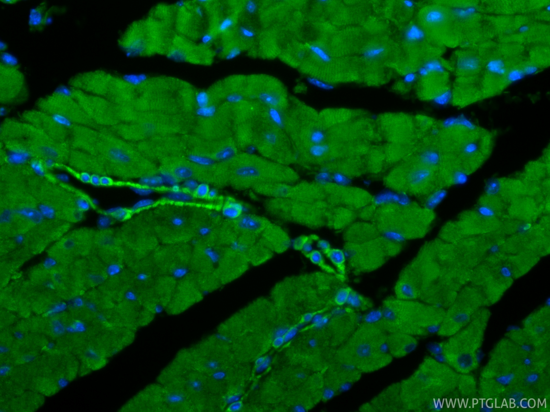 IF Staining of mouse heart using 20054-1-AP
