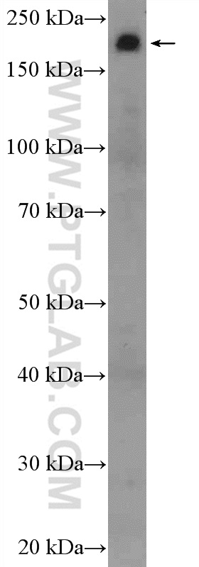 WB analysis of mouse heart using 20054-1-AP