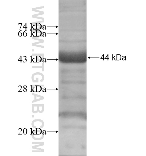 TNS4 fusion protein Ag14438 SDS-PAGE TNS4 fusion protein Ag14438 SDS-PAGE