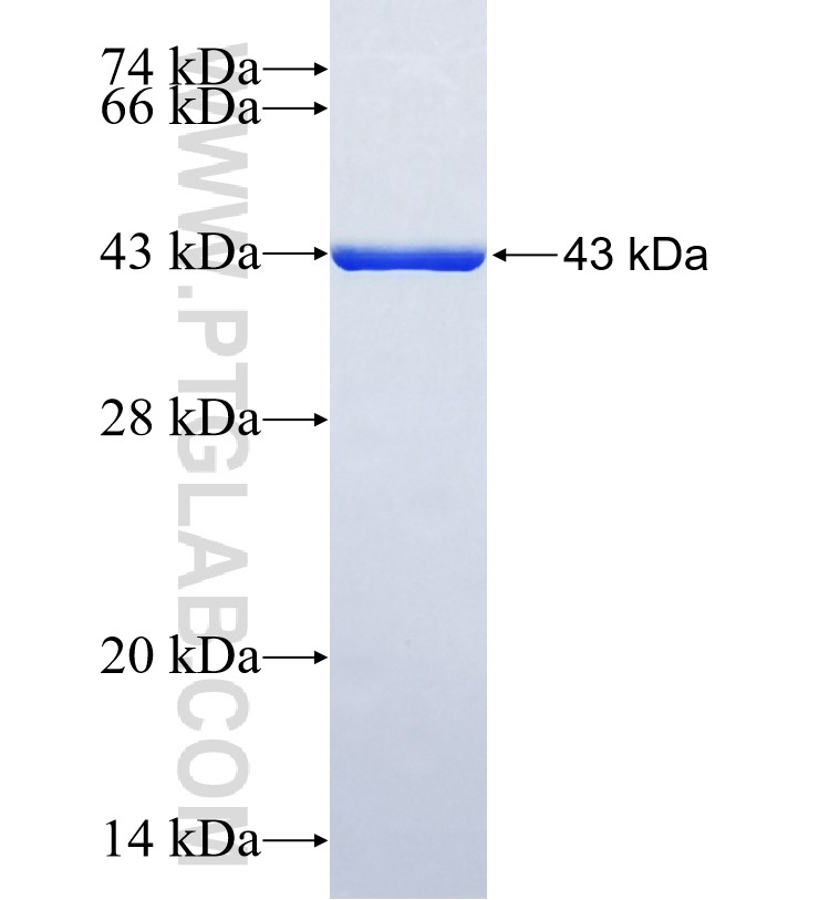TNXB fusion protein Ag30532 SDS-PAGE