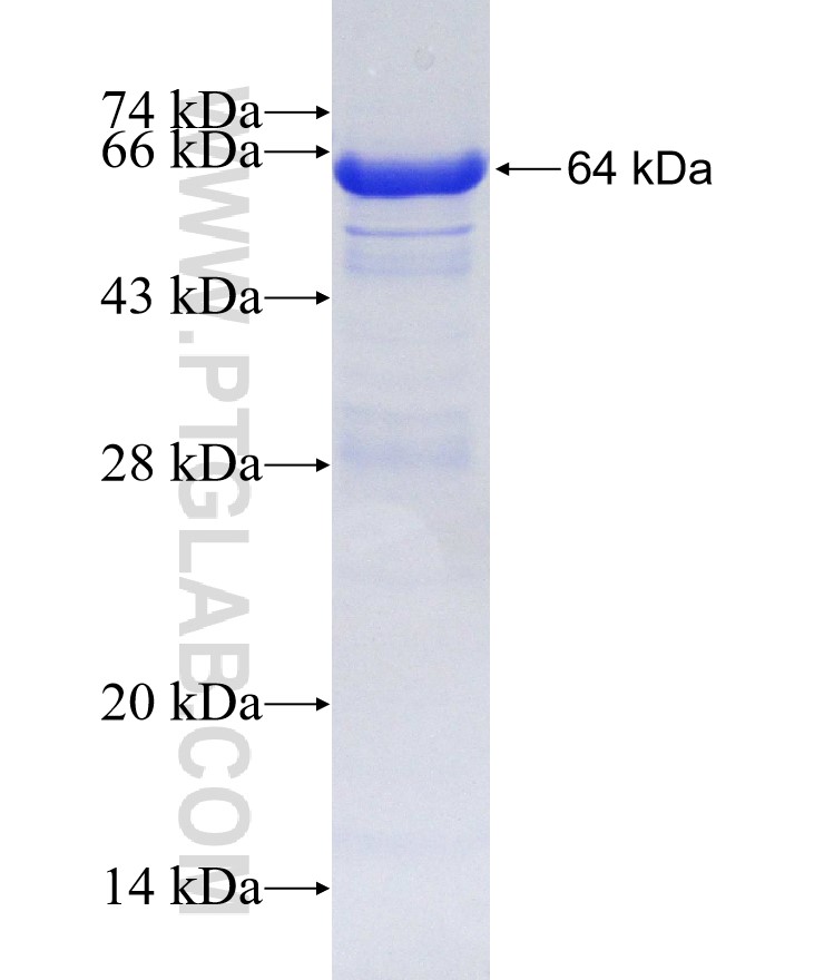 TNXB fusion protein Ag4501 SDS-PAGE