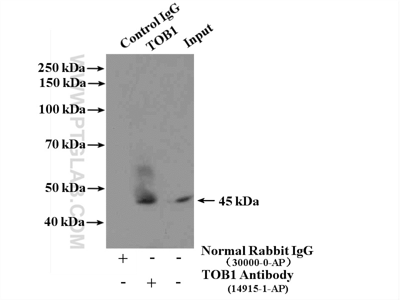 IP experiment of HeLa using 14915-1-AP