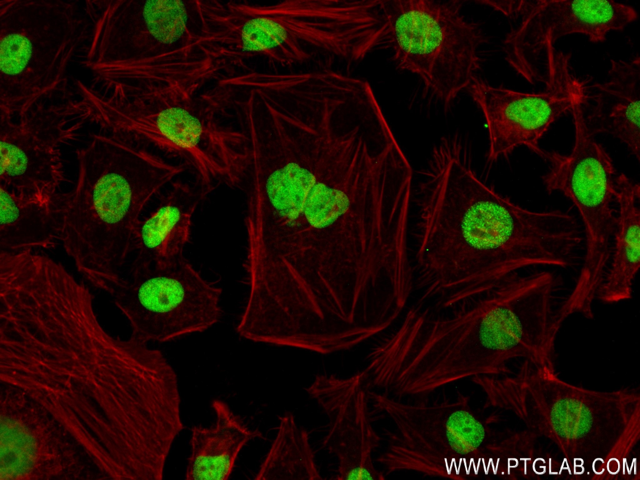 IF Staining of HeLa using 83944-2-RR