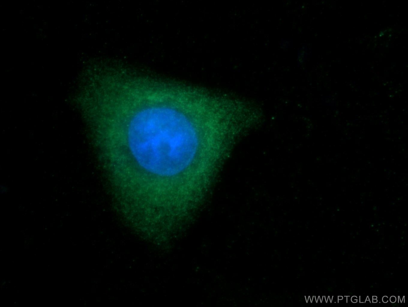 IF Staining of HepG2 using 13607-1-AP