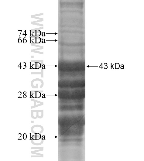 TOB2 fusion protein Ag14476 SDS-PAGE TOB2 fusion protein Ag14476 SDS-PAGE