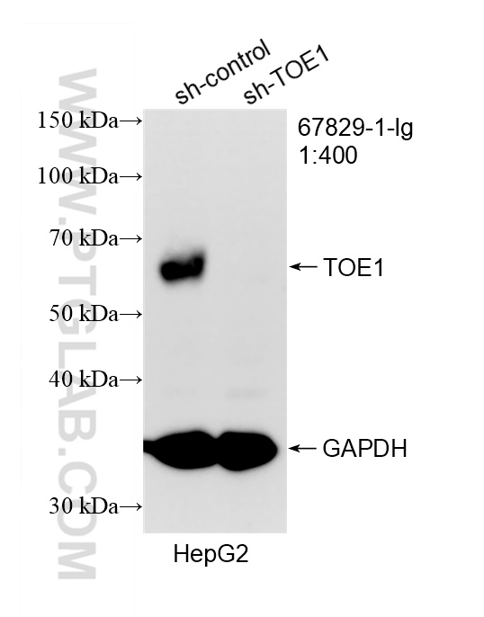 WB analysis of HepG2 using 67829-1-Ig (same clone as 67829-1-PBS) WB analysis of HepG2 using 67829-1-Ig (same clone as 67829-1-PBS)