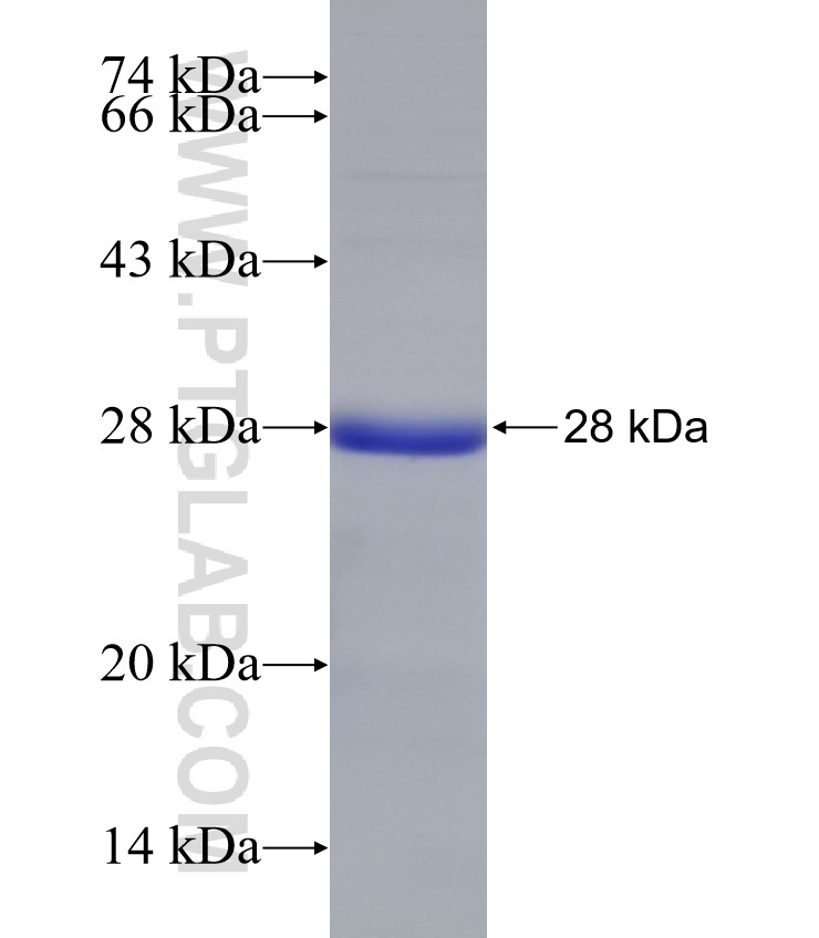 TOE1 fusion protein Ag31437 SDS-PAGE TOE1 fusion protein Ag31437 SDS-PAGE